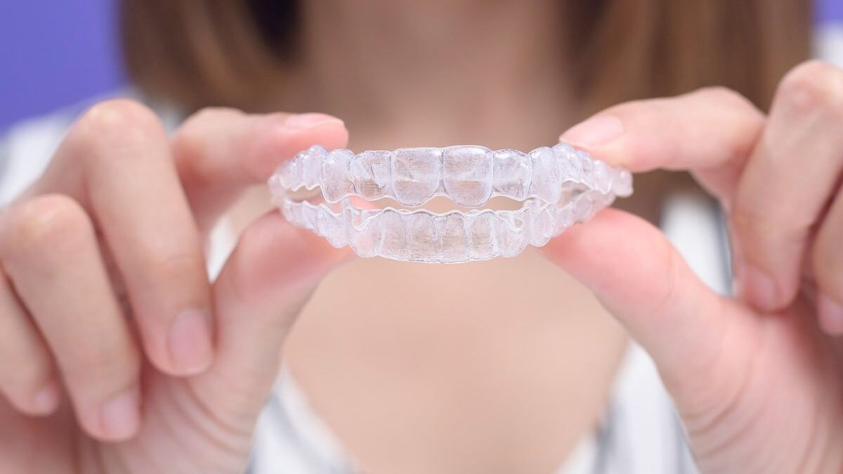 Are Clear Aligners Better Than Braces