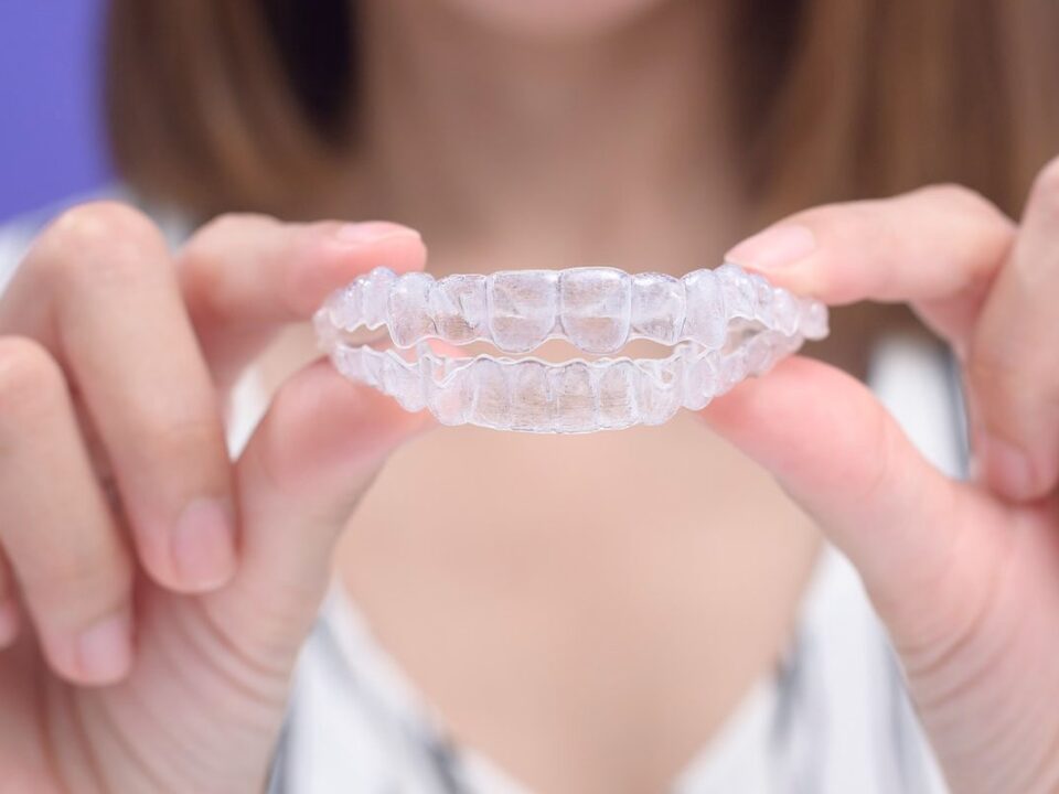 Are Clear Aligners Better Than Braces