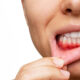 Can Periodontists Do General Dentistry