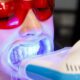 Do Teeth Whitening Trays Work?