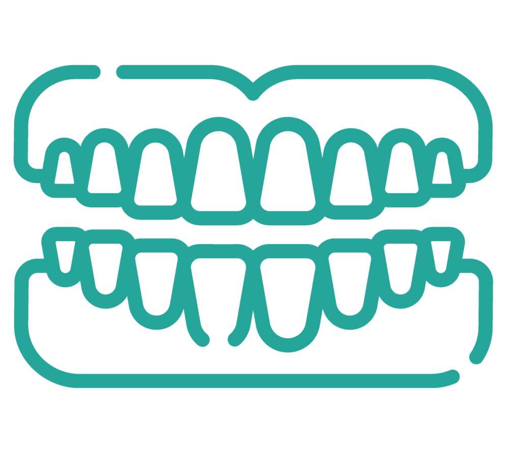 Full Mouth Reconstruction