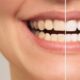 Tips for Dealing with Teeth Whitening and Tooth Sensitivity