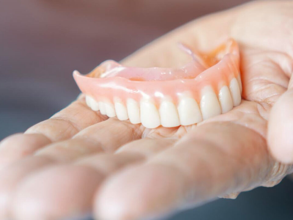 What Types of Materials Are Used in Making Dentures